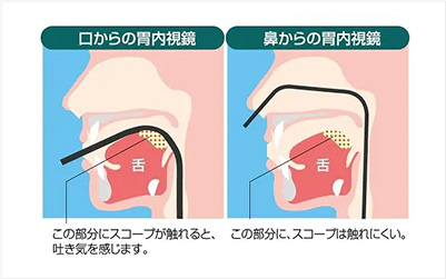 当院の大腸カメラについて