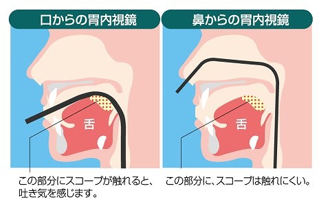 極細スコープ